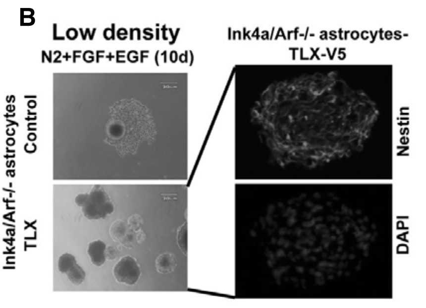 Neurosphere formation of TLX-overexpressing.jpg